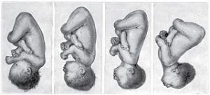 Face Presentation Movement