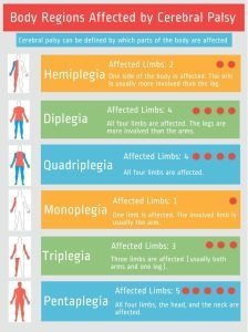 Body Parts Affected by Cerebral Palsy: Classification Based on Limb Involvement