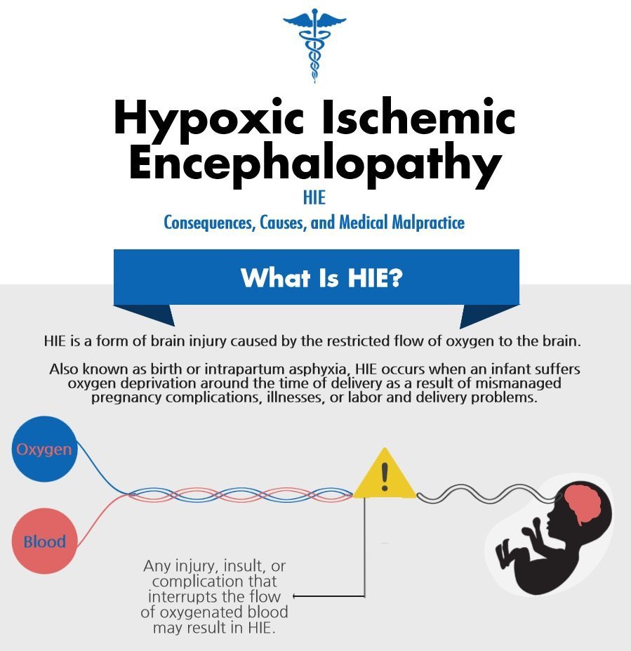 Hypoxic-Ischemic Encephalopathy (HIE) | Michigan Cerebral Palsy Attorneys