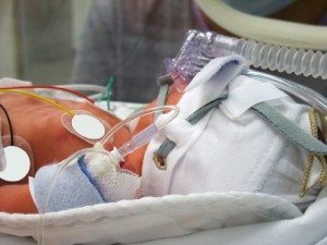 Detroit, Michigan Hypoxic Ischemic Encephalopathy (HIE) Lawyers