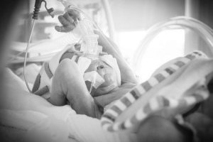 Cerebral Palsy from Fetal Stroke: Michigan Medical Malpractice and Birth Injury Lawyers