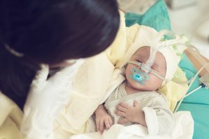 Michigan Attorneys Handling Cases Related to Birth Asphyxia / Hypoxic Ischemic Encephalopathy (HIE) and Nuchal Cords