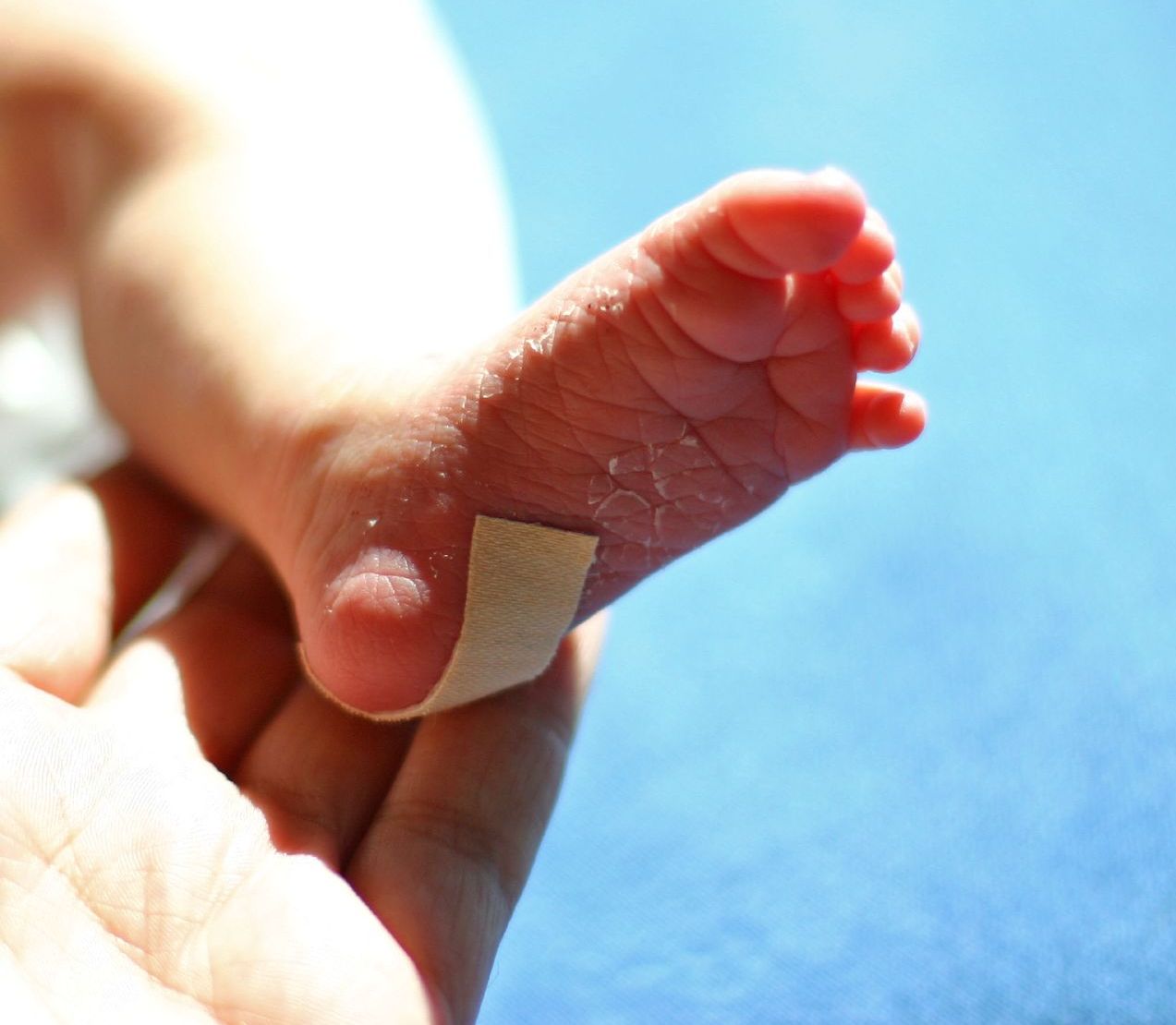 Vacuum Extractor and Forceps Injuries | Michigan Cerebral Palsy